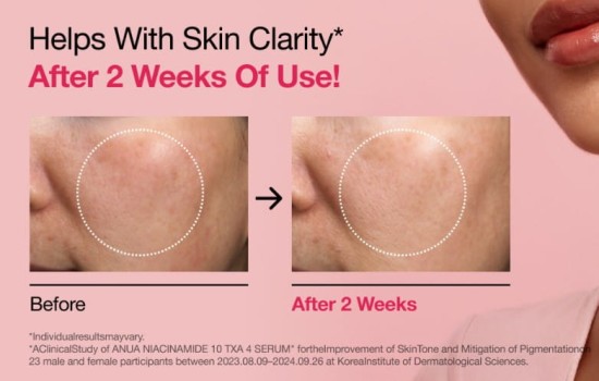 anua txa serum.jpg