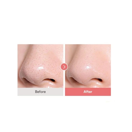 TOCOBO AHA BHA Lemon Toner, 150 ml – tonik z kwasami AHA, BHA i witaminą C (5).jpg